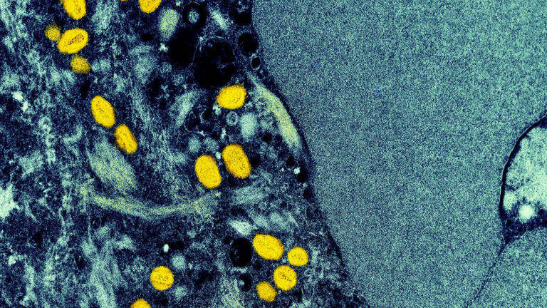 五问猴痘传播：它是性传播疾病吗？会通过空气传播吗？