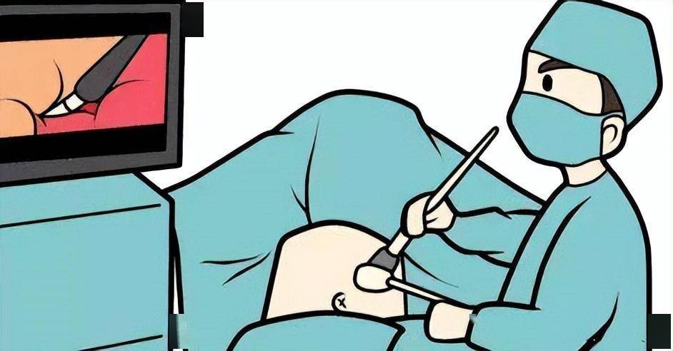这种方式的腹腔镜手术,真正实现腹部"零瘢痕"_单孔_脐部_子宫