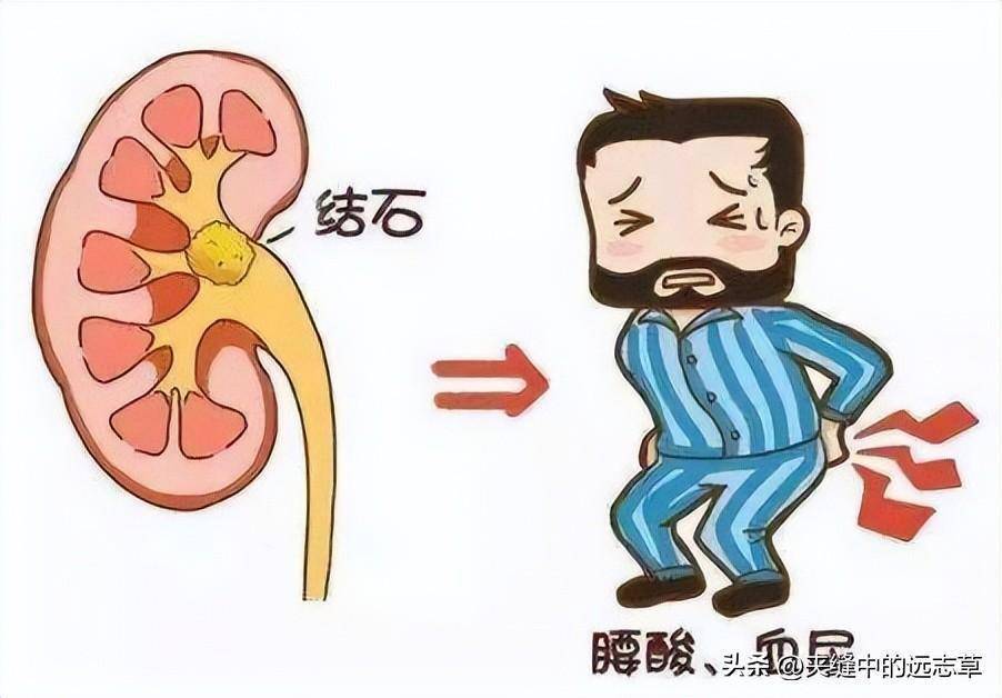 送你十味中药,清热排石,止血止痛,标本兼治_石淋_膀胱_砂石