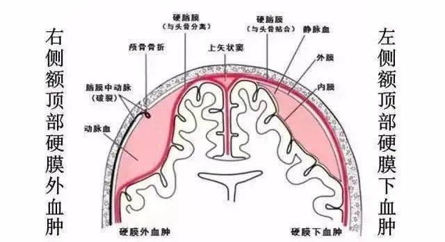 产后血肿的症状图片图片