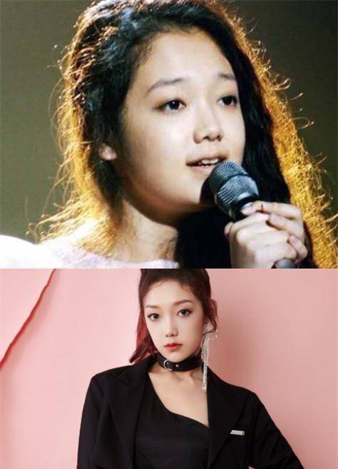 先讲下王艺瑾,这么完美无缺的女生,之前竟然有张十分普通的脸.