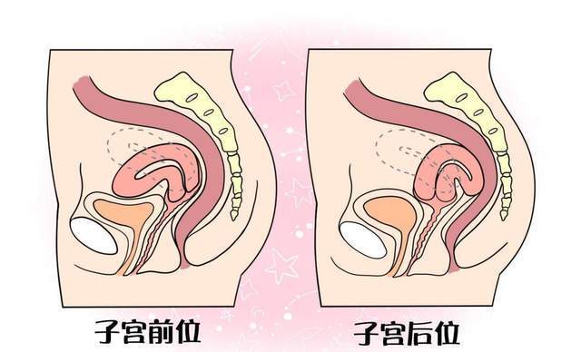 宫腔下段图片