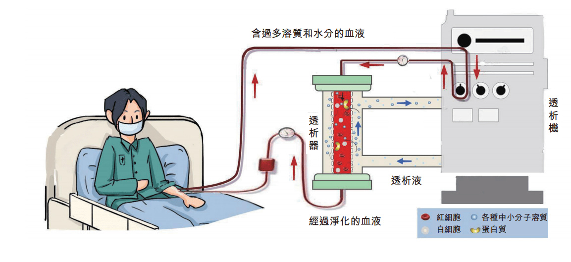 威高空心纤维透析器图片