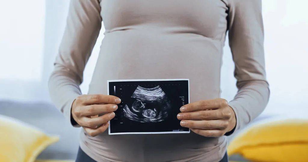 怀孕三个月宝宝彩超图图片
