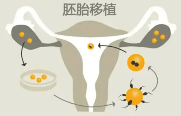 如果移植的是第5天的囊胚,通常胚胎移植后1-2天会着床,具体可根据个人