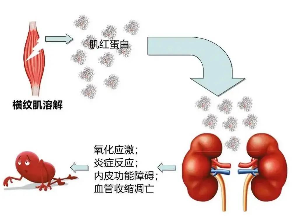 学校组织突击锻炼,学生练到肌肉溶解,是学生太娇弱还是学校太暴力