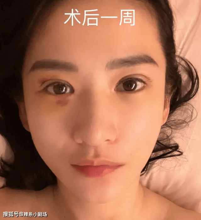 胡某_手术_小时候