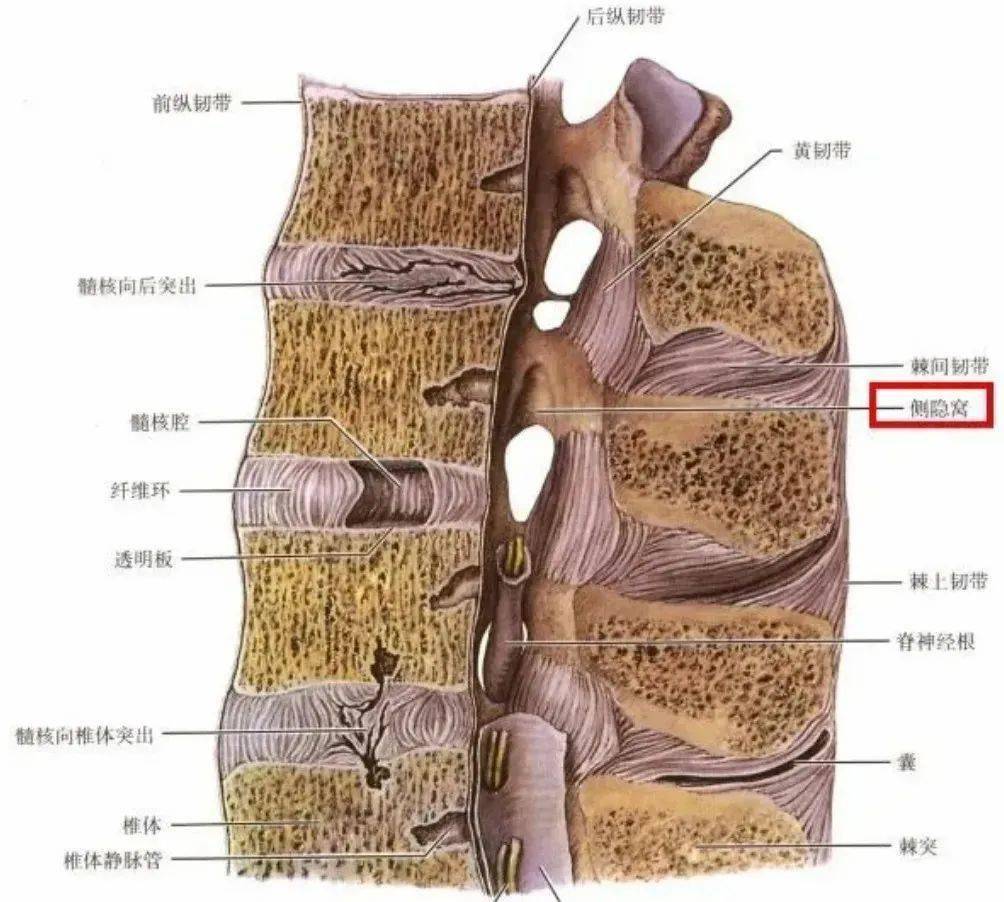 椎间孔侧隐窝图片