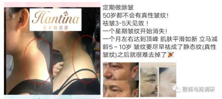 臻诺熹旗下皇家韩缇娜承诺一分钟就见效 四级代理模式(图10)