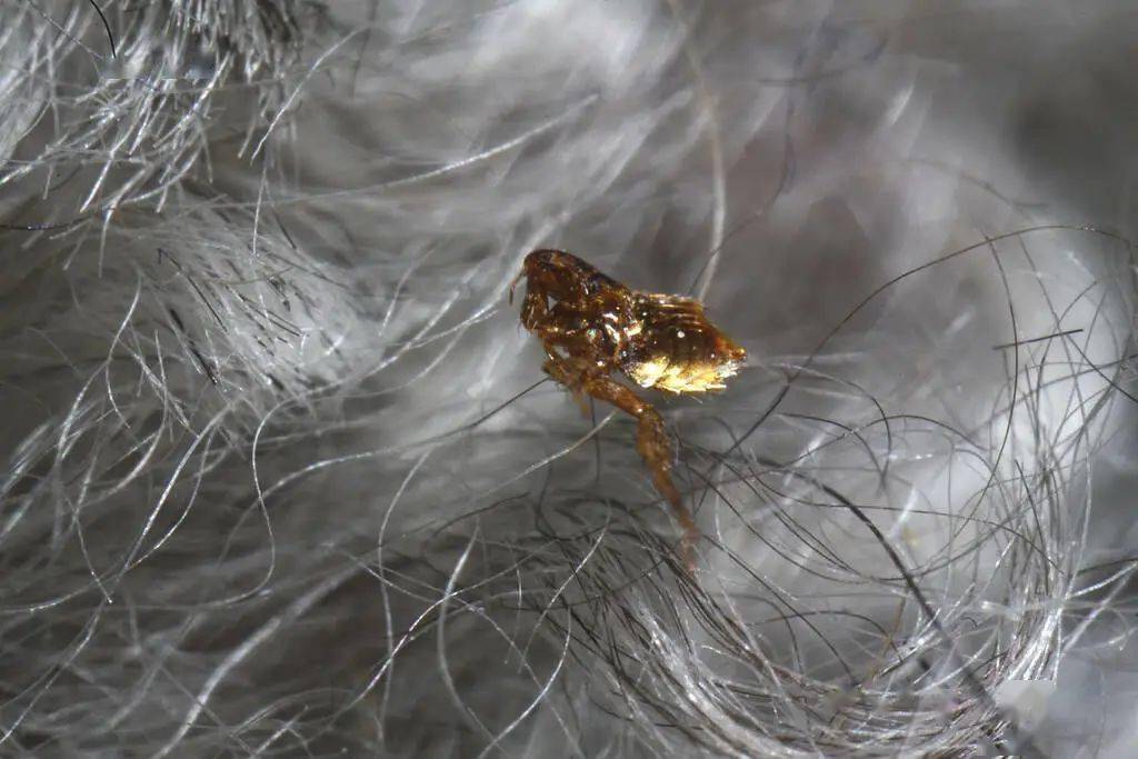 河北一老人头痛欲裂竟是被蜱虫连吸数日,医生在患者大腿后侧发现蜱虫