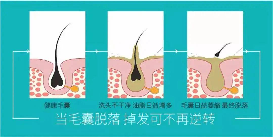 怎么保养头发不脱发(女士掉头发吃什么生发最快)