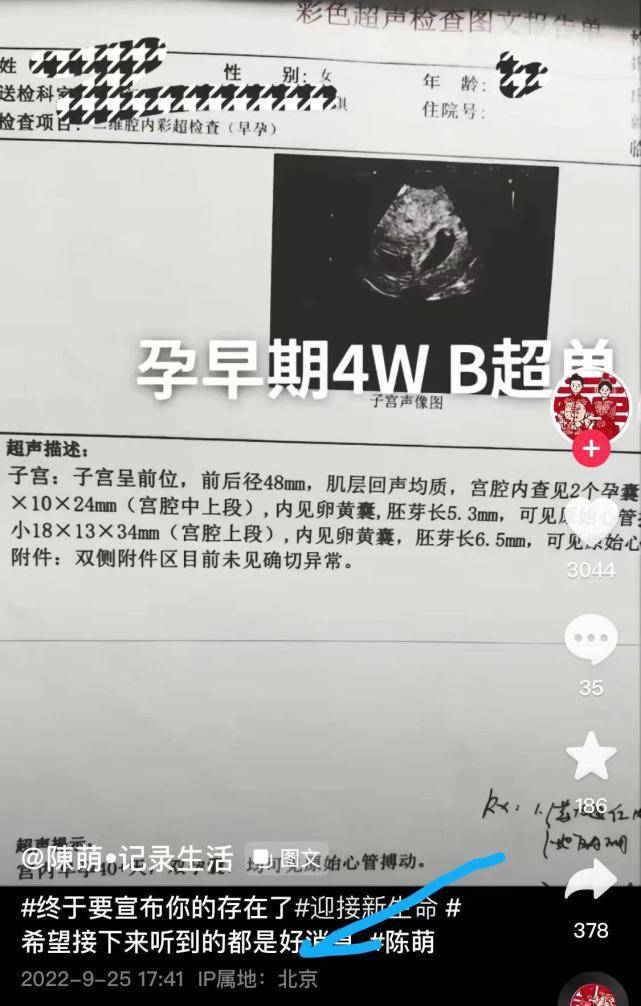 大衣哥儿媳被曝怀双胞胎后