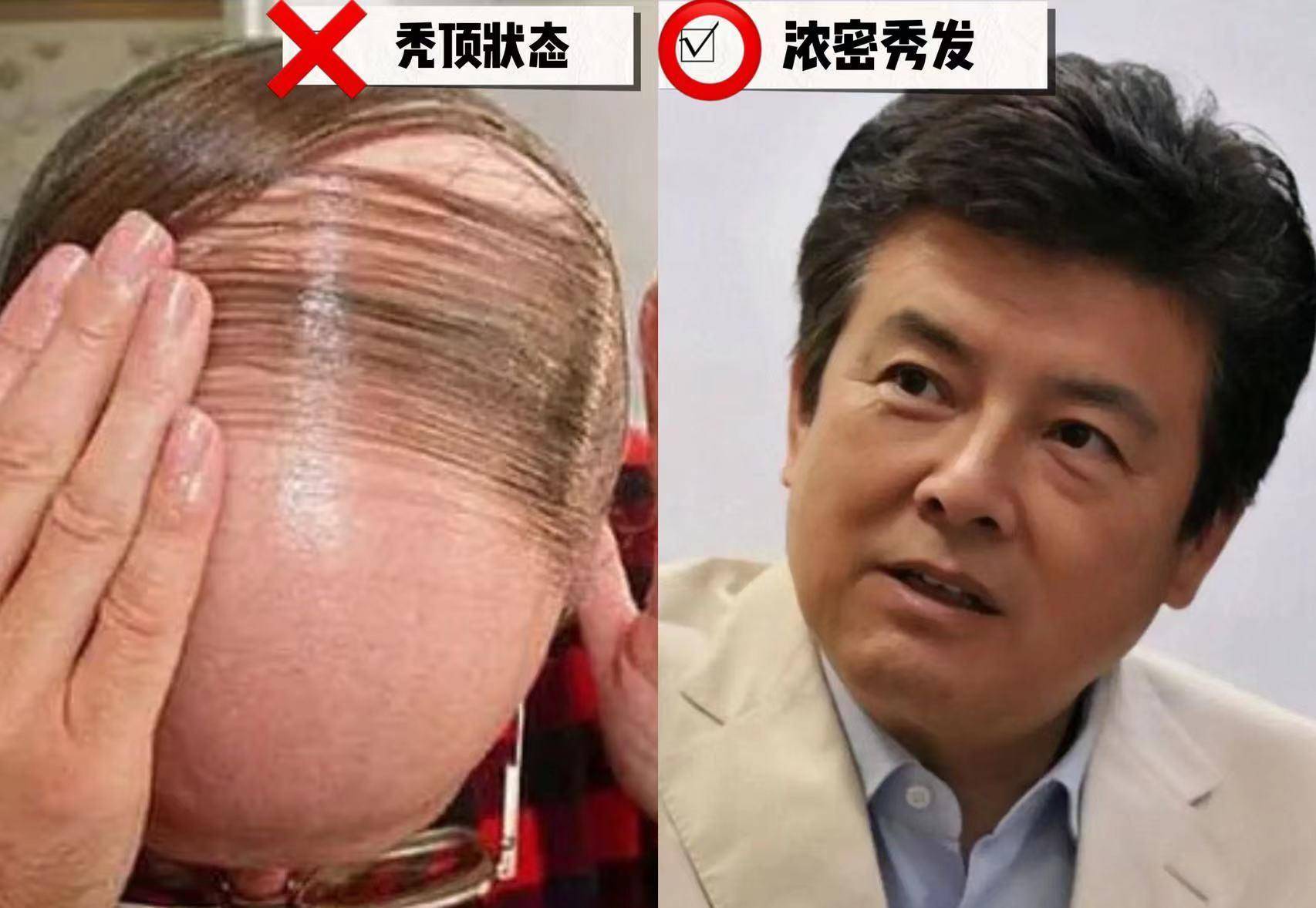 反油腻的男人:过60岁仪态儒雅,穿衣不老气又高级_苗侨伟_发型_中年