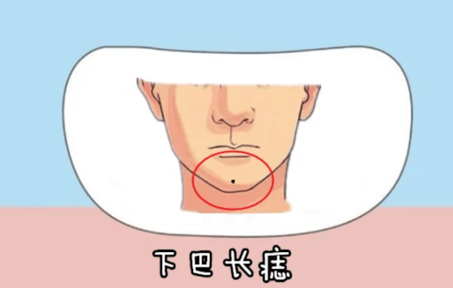 也表示其人能喝酒,如是恶痣,小心醉酒与水厄,女人有恶痣,要提防夫妇