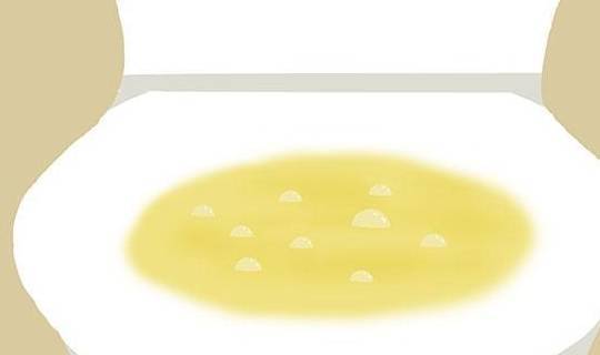 尿液发黄 且异味大 是咋回事 需警惕 也许是疾病信号 时候 颜色 身体