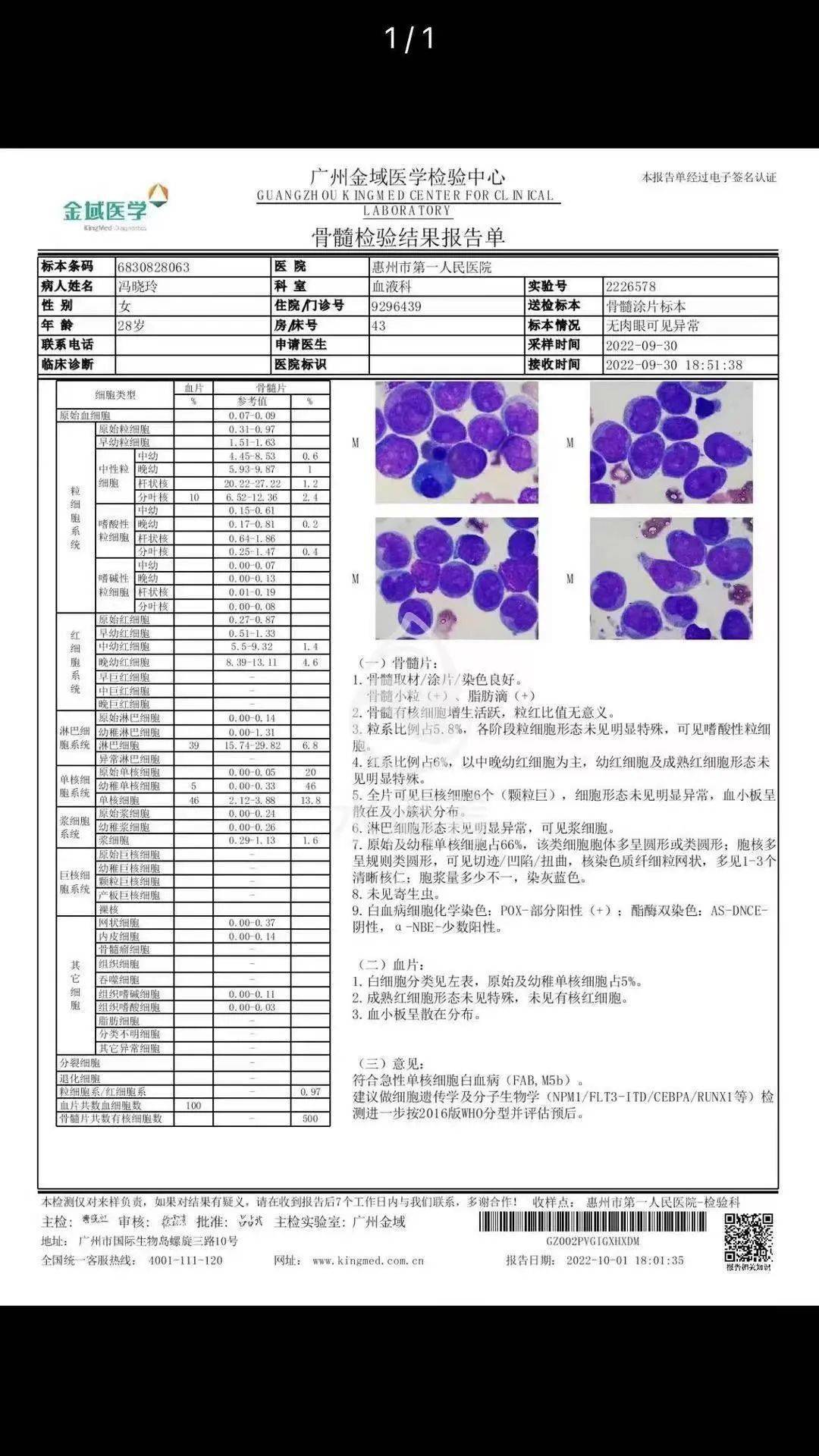 水口28岁女子患白血病,恳请大家帮助_生活_妻子_人士
