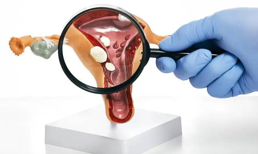 孕40周见红分泌物图片图片