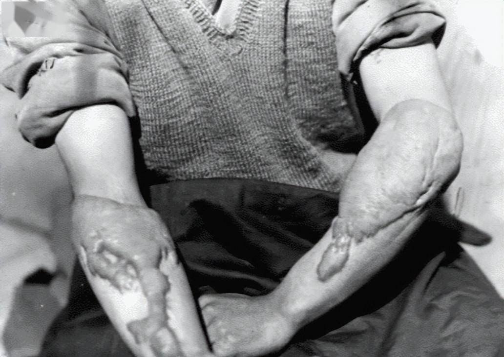 美国暗中购买大量防核辐射药,核武器爆炸后果多严重?