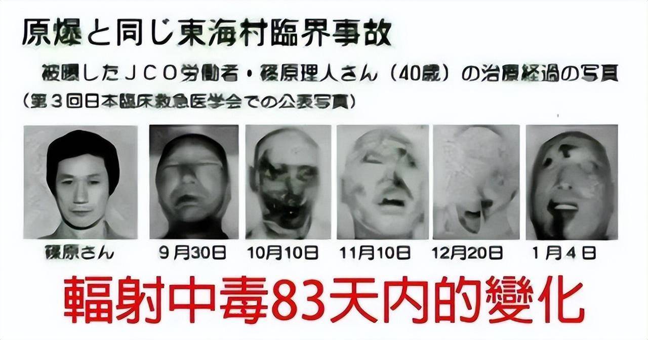 生死15分钟！所有人都必看的救命知识！核战爆发后我们如何生存？_手机搜狐网