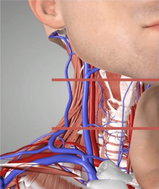 颈内静脉定位图片