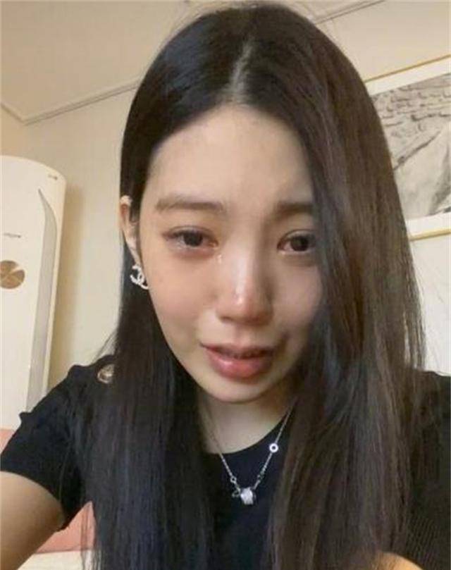 酒驾受伤一年多,韩国女星lizzy被嘲变脸,演艺事业堪忧_偶像_直播_机会