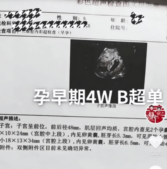 成骗婚?陈萌疑似假怀孕,朱小伟已去医院做检查,大衣哥满脸愁容