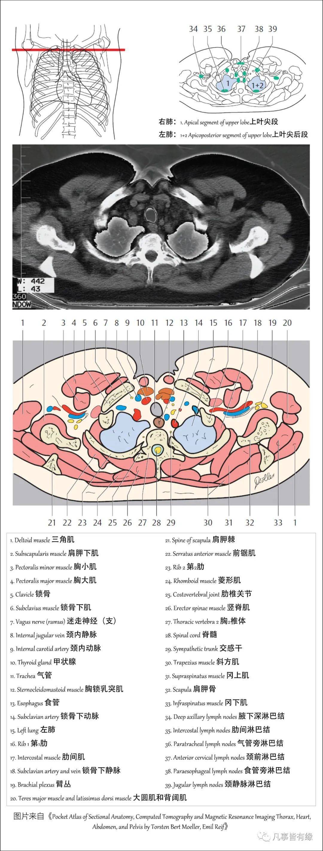 【保藏】胸部的断层剖解