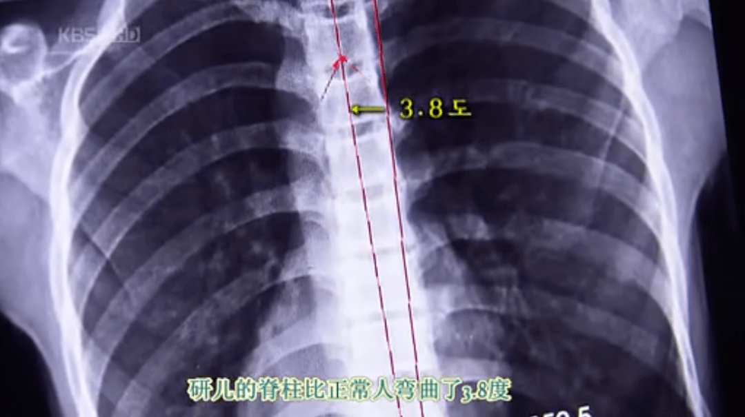 32岁韩国一姐下嫁小5岁爱豆！仙女外型冷艳网友：我的青春嫁人了