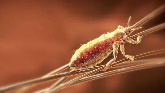 孩子头发里出现很多小白点 这并不是什么大个的头皮屑,而是头虱!