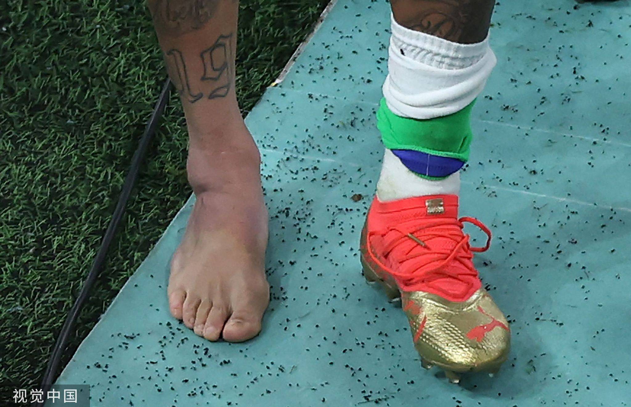 内马尔右脚出现明显肿胀瘀血情况_比赛_受伤_伤情