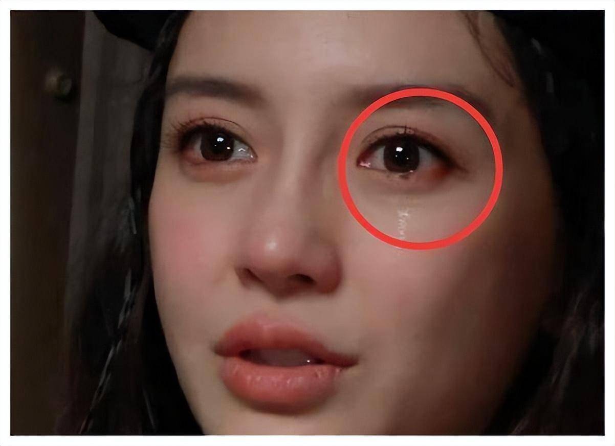 baby哭到脱妆,眼角的"痕迹"明显_杨颖_节目_手术