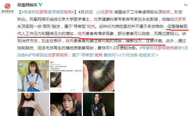在沈梦辰斑秃上了热搜之后,有网娱记者连线了北京大学医学博士刘永生