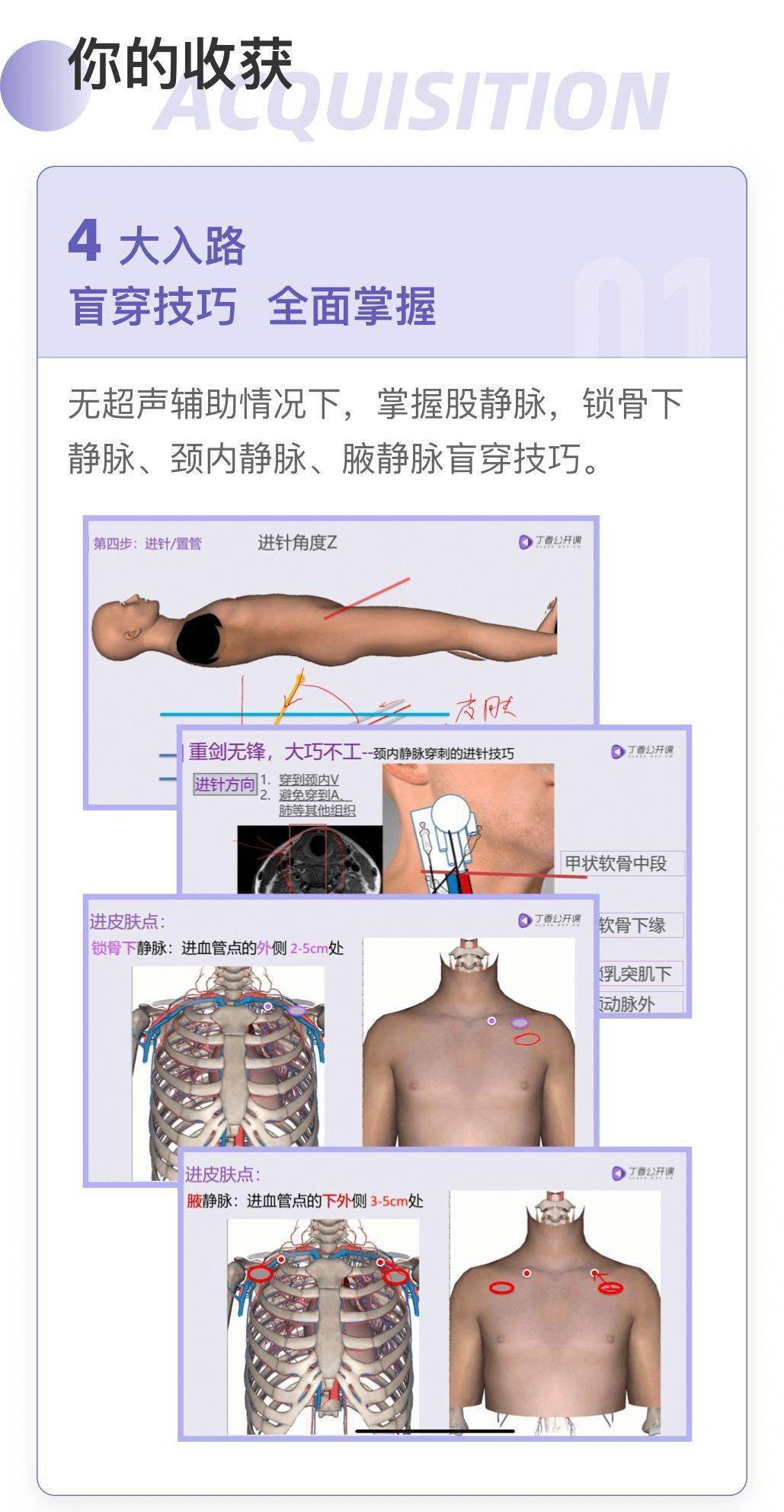 气胸穿刺点图片