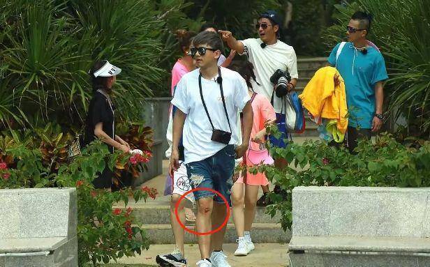 同样录制节目的时候,张杰被拍到腿上被擦破.