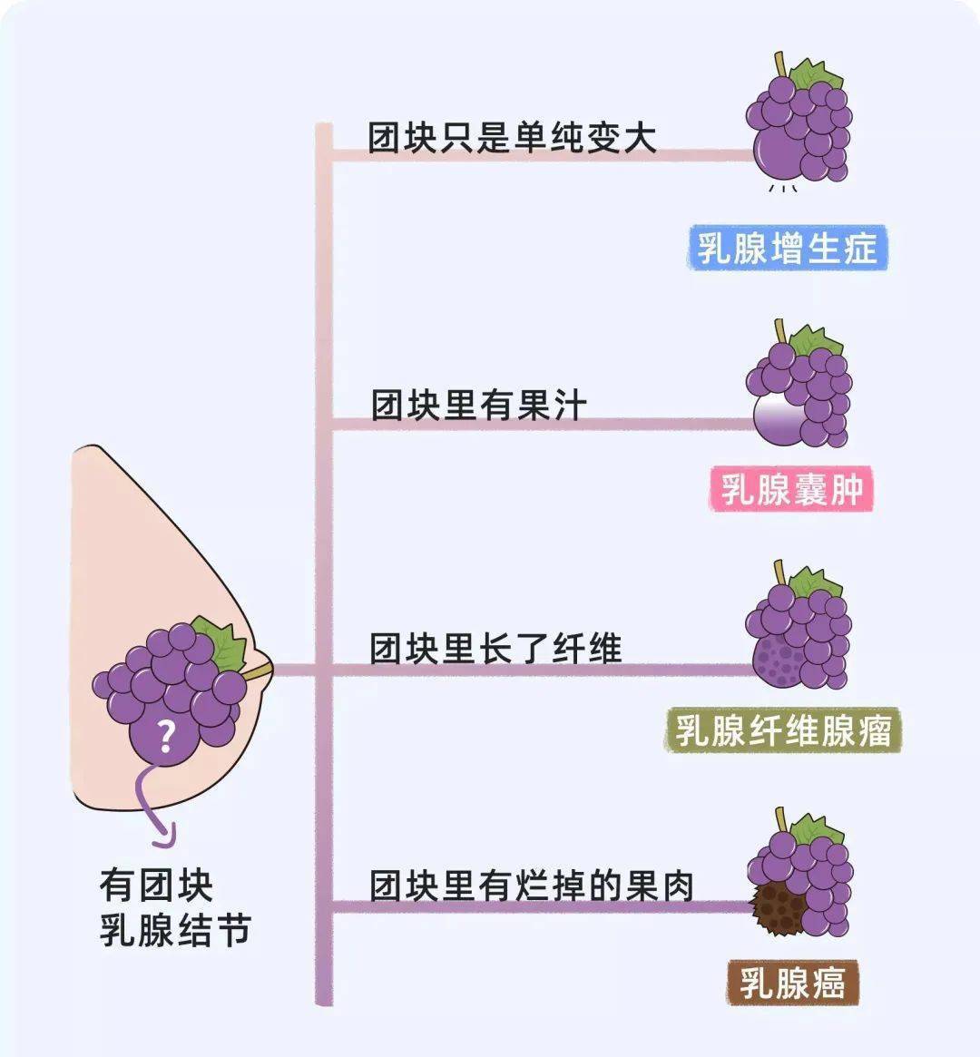 【科普大赛14】查出乳腺囊肿担惊受怕?