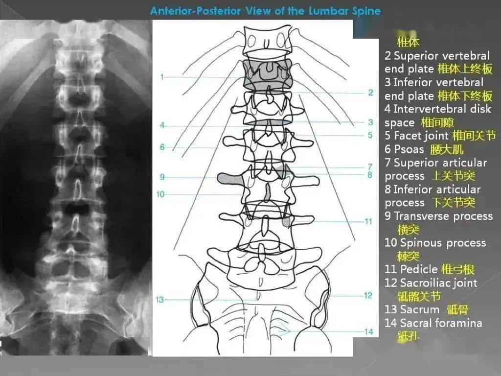 正常腰椎x光图片图解图片