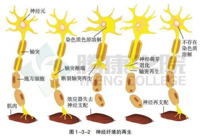 tinel征图片