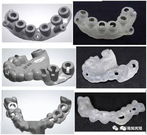 3d打印製作高精度齒科種植導板,你需要這樣一款樹脂!