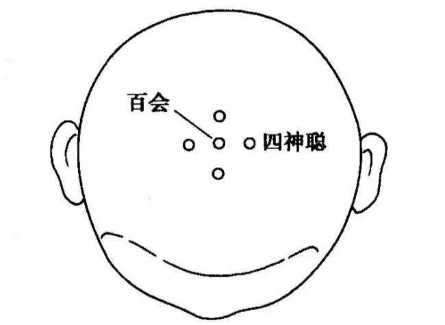 疾病_包括_针灸