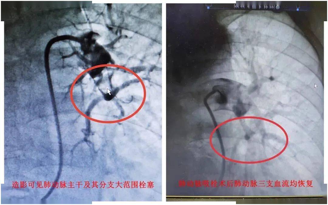 放射線医学大系 (33)-