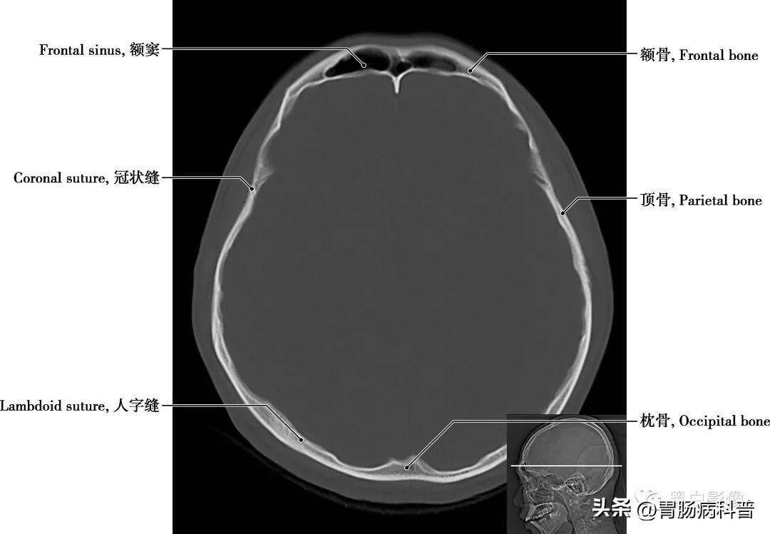 详细标注版