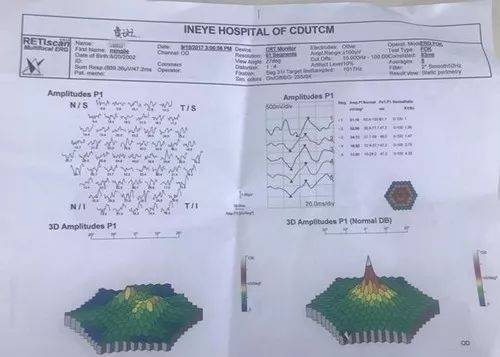 1岁娃误吞水宝宝致肠梗阻：过年时，13种伤娃玩具万万别给孩子玩！