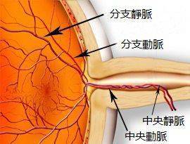 冬季天冷，眼前突然一黑又自动恢复，你经历过吗?？