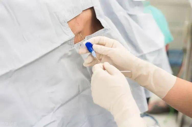 图为医生采集某患者脑脊液样本针对有网友注意到,论文中提到该患者为"