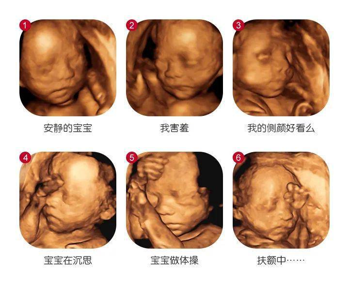 10周胎儿四维彩超图图片