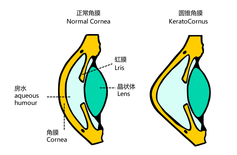 角膜剖面图图片