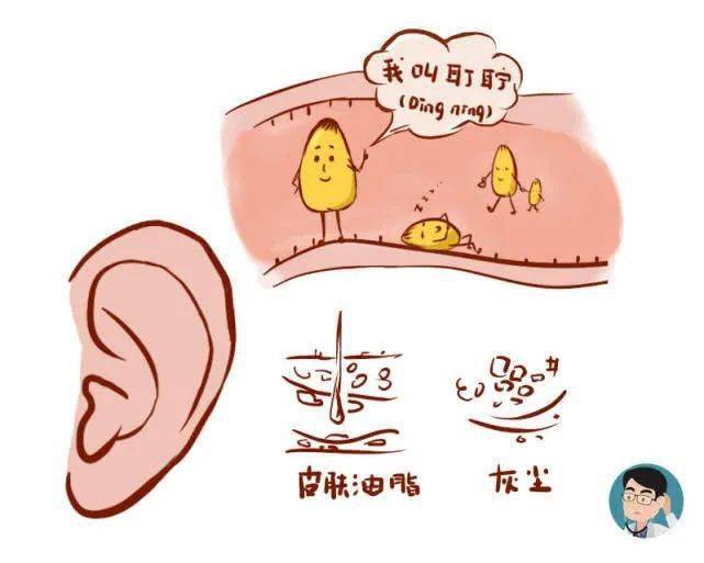 30%的孩子存在耵聍栓塞