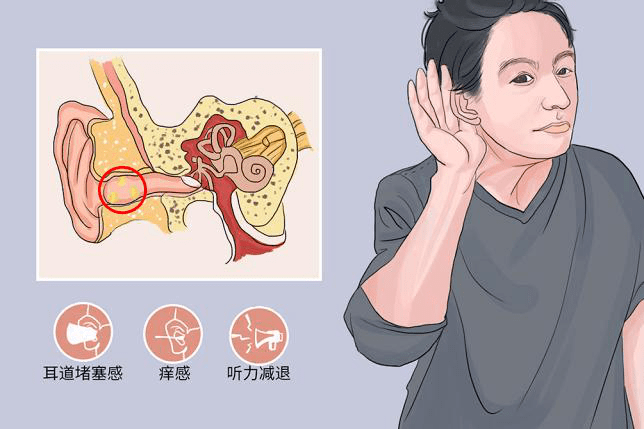 如果掏耳朵用力不當,可引起外耳道損傷感染導致癤腫,引起耳部疼痛