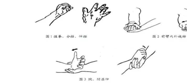 手腕骨折正确锻炼图片图片