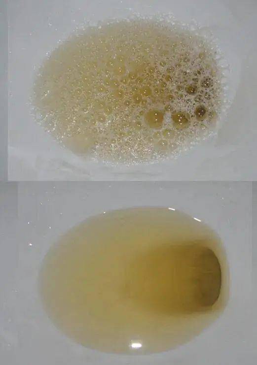 女性尿液寄生虫图片图片